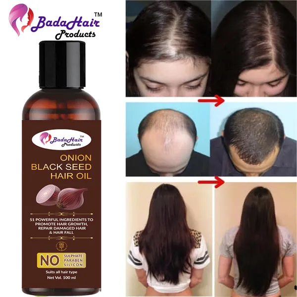 Pure_Onion_Oil_-_Cold_Pressed_-_For_Stronger_Hair,_Skin_&_Nails_-_200_Ml