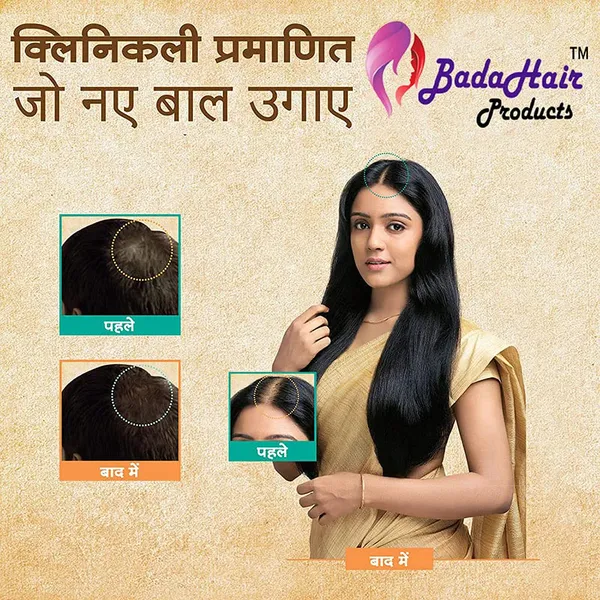 Bringraj,Onion,Reetha,Shikakai,Amla,Shampoo_And_Red_Onion_Seed_Oil_Extract,_Black_Seed_Oil_&_Pro-Vitamin_B5_-_No_Parabens,_Sulphates,_Silicones,_Color