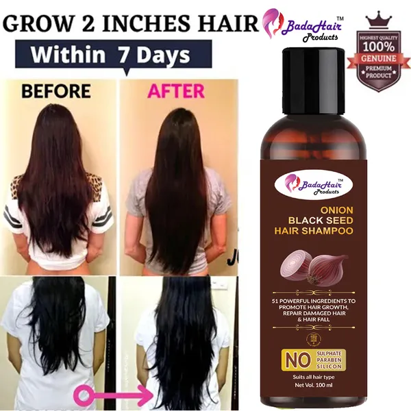 Red_Onion_Hair_Oil_&_Shampoo_For_Women/Men,_Remove_Dandruff,_Hair_Fall_Control_-_300_Ml,_Mahendi_Free