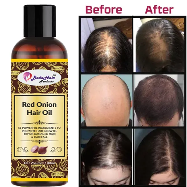 Natural_Red_Onion_Oil_&_Red_Onion_Shampoo_(100Ml_Each,_Mahendi_Free)