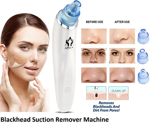 Prague_Microfibre_Blackhead_Remover_Vacuum_Suction_Device_(Pack_of_4)