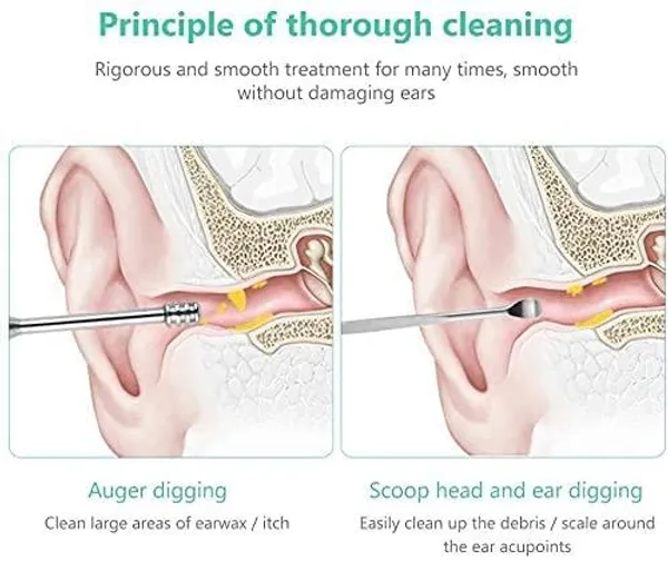 easy_to_clean_and_sterilize_Ear_wax_remover