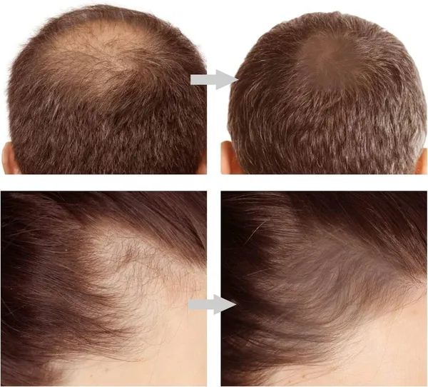 Black_Hair_line__Root_touch-up_powder