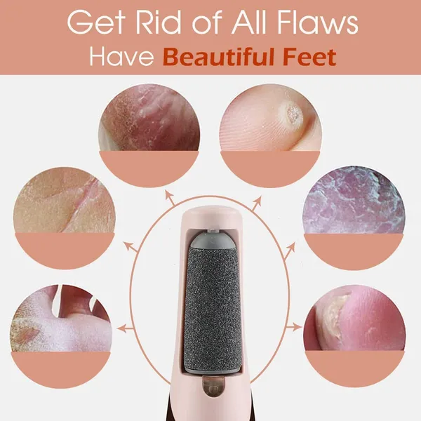 Pink_Callus_Remover_For_Feet,_Foot_Scrubber_For_Dead_Skin,_Pedicure_Kit_For_Women_For_Foot,_Pedicure_Machine,_Dead_Skin_Remover,_Foot_Scrubber,_Pedicure_Tools_For_Feet,_Foot_Scrubber_For_Dead_Skin