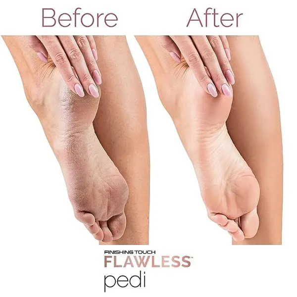 Pink_Callus_Remover_For_Feet,_Foot_Scrubber_For_Dead_Skin,_Pedicure_Kit_For_Women_For_Foot,_Pedicure_Machine,_Dead_Skin_Remover,_Foot_Scrubber,_Pedicure_Tools_For_Feet,_Foot_Scrubber_For_Dead_Skin