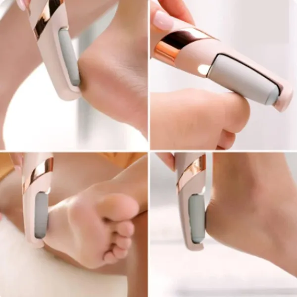Pink_Callus_Remover_For_Feet,_Foot_Scrubber_For_Dead_Skin,_Pedicure_Kit_For_Women_For_Foot,_Pedicure_Machine,_Dead_Skin_Remover,_Foot_Scrubber,_Pedicure_Tools_For_Feet,_Foot_Scrubber_For_Dead_Skin
