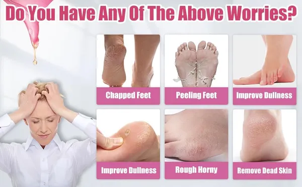 Pink_Silicone_Moisturizing_Silicone_Gel_Socks_For_Women_And_Men_Gel_Socks_For_Dry_Cracked_Feet_Crack_Heel_Repair_Socks_Foot_Moisturizer_Socks_Spa_Gel_Socks_Natural_Oil_And_Vitamin_E_-_1_Pair