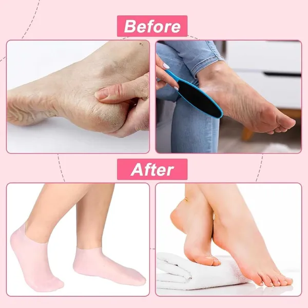 Pink_Silicone_Moisturizing_Silicone_Gel_Socks_For_Women_And_Men_Gel_Socks_For_Dry_Cracked_Feet_Crack_Heel_Repair_Socks_Foot_Moisturizer_Socks_Spa_Gel_Socks_Natural_Oil_And_Vitamin_E_-_1_Pair