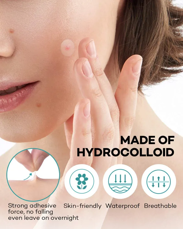 Transparent__Acne_Pimple_Patches_-_Pack_of_2_(72_Pcs)