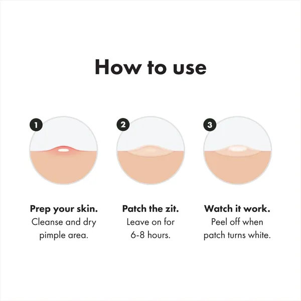 Transparent__Acne_Pimple_Patches_-_Pack_of_2_(72_Pcs)