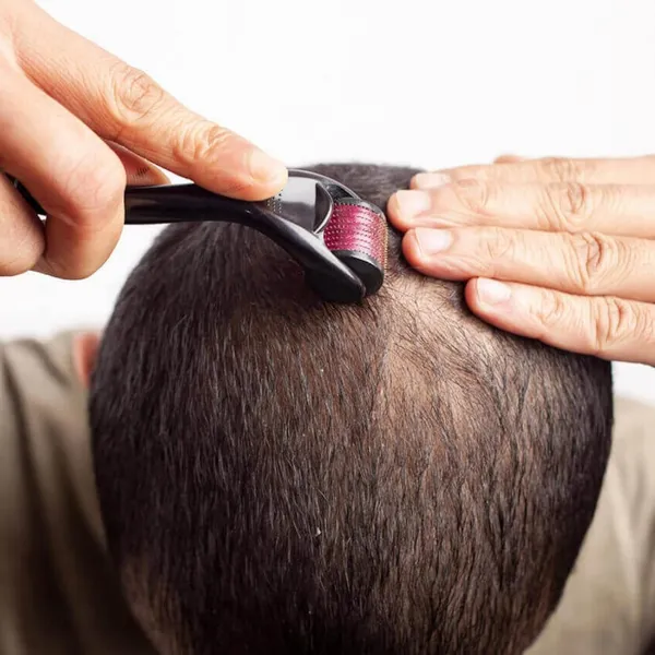 Black__Advanced_Hair_Activator_Derma_Roller_(For_Scalp_and_Beard)